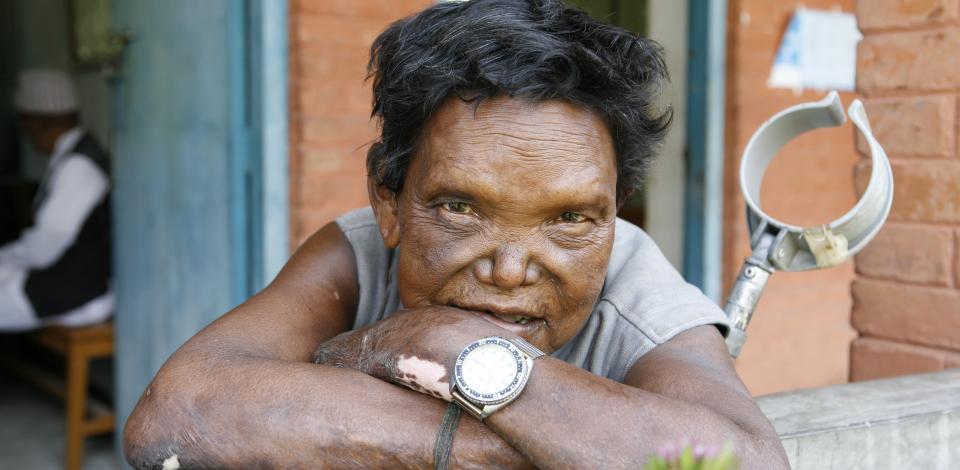 help to lepers